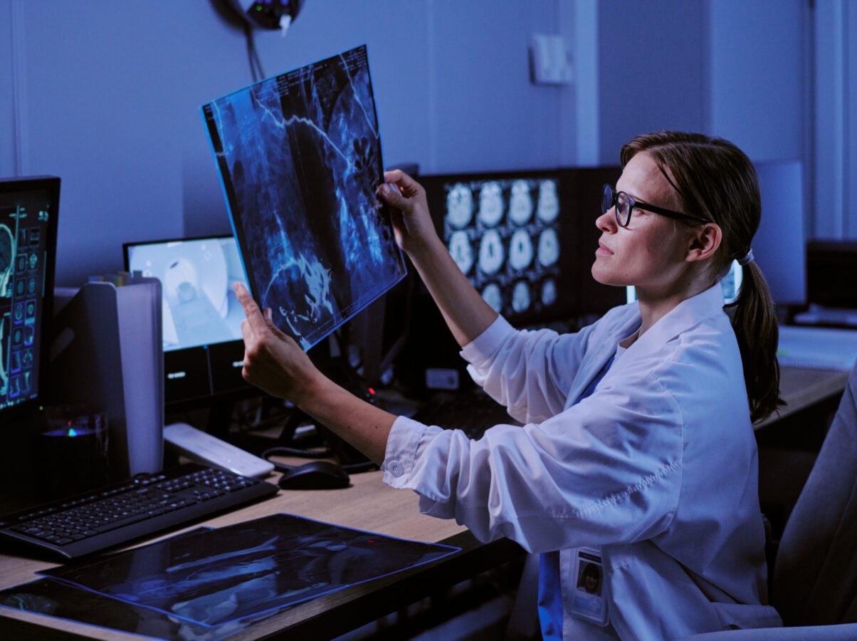 Caucasian young adult woman doctor examining X-ray scan at workstation in medical imaging center, analyzing radiology images on computer monitors, wearing eyeglasses and lab coat